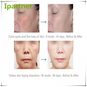 Forró eladás LED fotonterápiás szépségápoló berendezések bőrápoláshoz