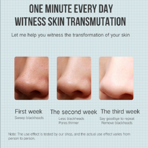 Elektromos extraháló akne eltávolítás Blackhead eltávolító vákuum szépség gép pórus tisztító