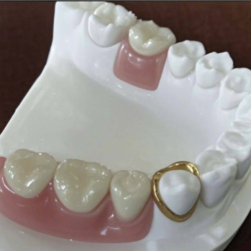 Pontossági rögzítés