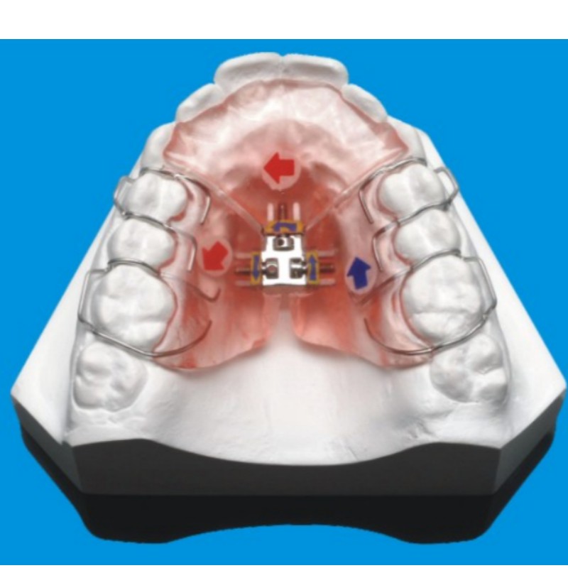 Ortodontikus sorozat